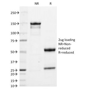 Monoclonal Mouse Anti-Human IgA Secondary Antibody (clone HISA43, IHC, IF)