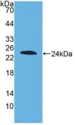 DISC1 Antibody (aa102-261, PE)