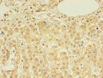 Polyclonal Rabbit anti-Human DHRSX Antibody (IHC)