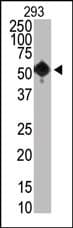 SETD8 / SET8 Antibody (N-Terminus, clone 43AT890)