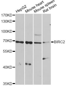BIRC2 / cIAP1 Antibody (aa1-300)