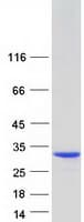 Human CT45A3 Protein (Recombinant Myc-DDK (Flag))