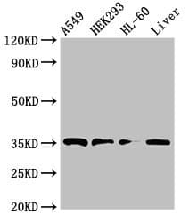 PPT1 / CLN1 Antibody