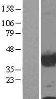 CNN1 / Calponin Protein (Over-Expression Lysate Myc-DDK (Flag))