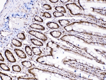 HMG1 / HMGB1 Antibody