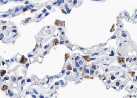 BCAR1 / p130Cas Antibody (phospho-Tyr410)