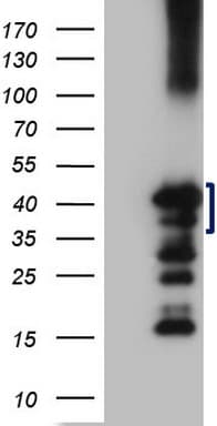 ZC3H8 Antibody (clone OTI5D1)