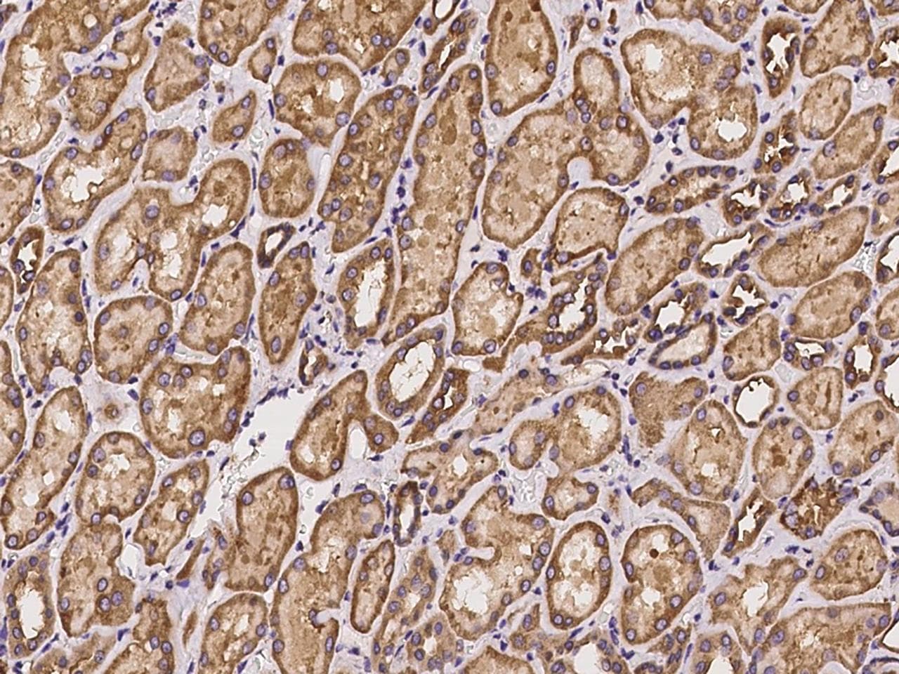 Polyclonal Rabbit anti-Human CAPRIN1 Antibody (IHC, IF)