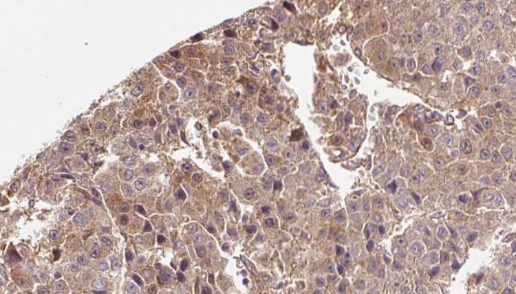 SLC2A3 / GLUT3 Antibody