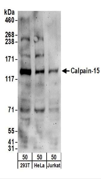 Polyclonal Rabbit anti-Human CAPN15 / SOLH Antibody (aa25-75, WB)