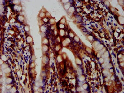 OTUD7B / Cezanne Antibody