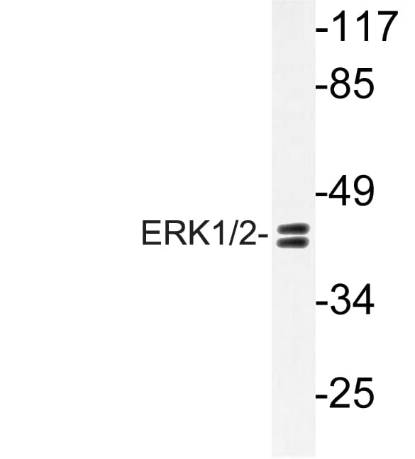 ERK1 + ERK2 Antibody (His197)