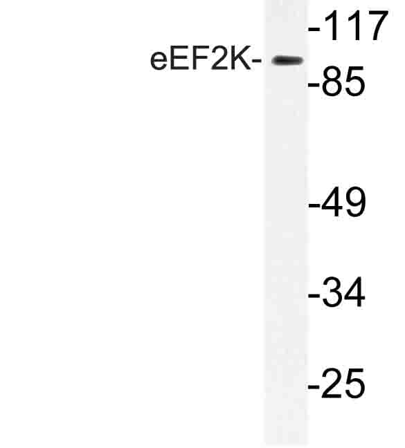 EEF2K Antibody (Gly358)