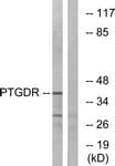 IHC-plus™ Polyclonal Rabbit anti-Human Prostaglandin D2 Receptor Antibody (aa263-312, IHC, IF, WB)