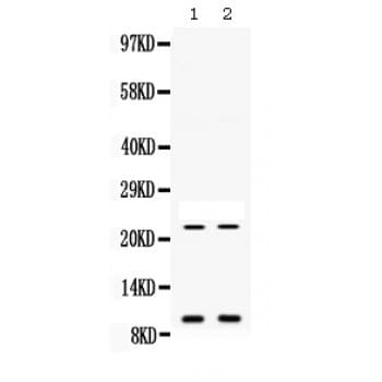 PROK1 / EG-VEGF Antibody (aa20-105)