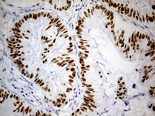 Monoclonal Mouse anti-Human KLF5 / BTEB2 Antibody (clone OTI6D2, aa1, IHC, WB)