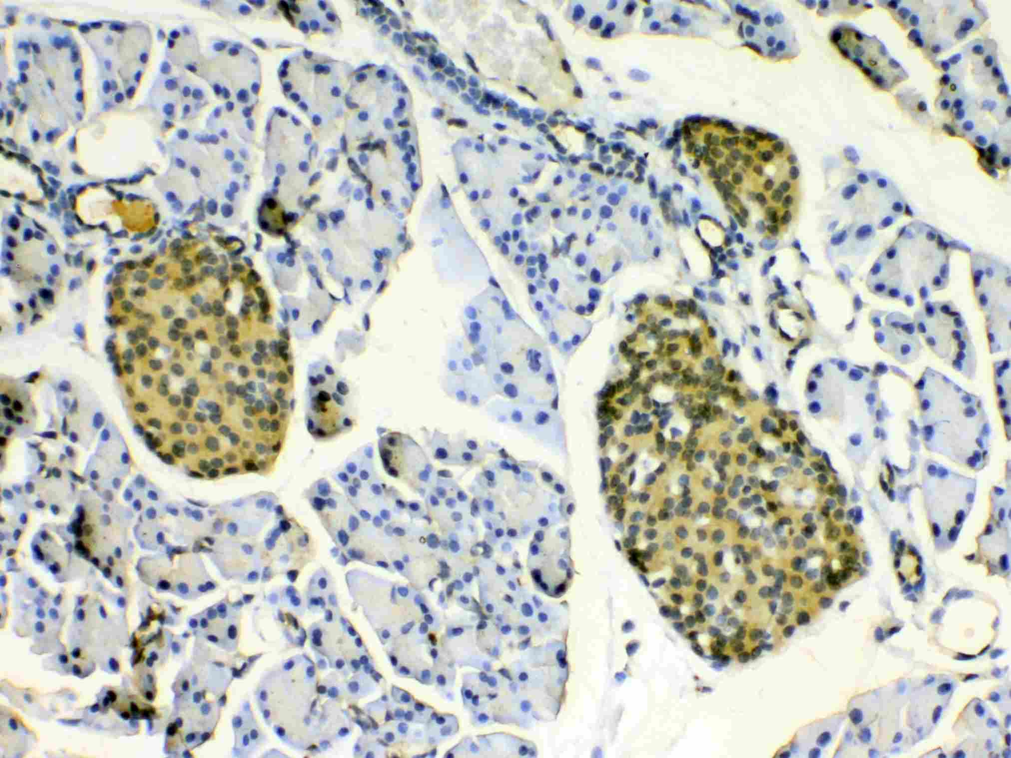 HSPB8 / H11 / HSP22 Antibody
