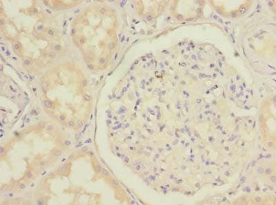 MGME1 / C20orf72 Antibody
