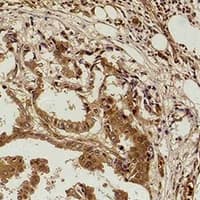 Methyl-Lysine Antibody