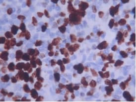 MKI67 / Ki67 Antibody (Internal)