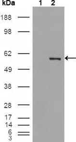IHC-plus™ PEA3 / ETV4 Antibody (clone 1A2G3)
