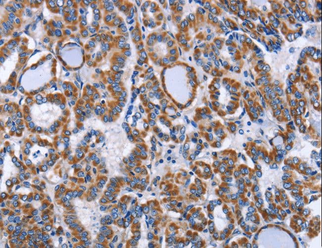 INTS10 Antibody