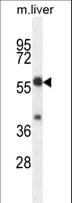 Polyclonal Rabbit anti-Human TBCCD1 Antibody (aa491-520, WB)