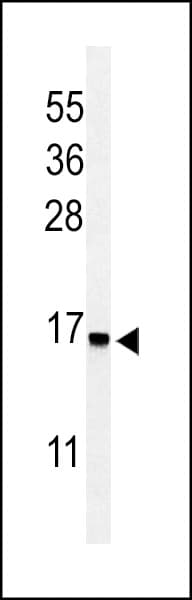 RPS25 / Ribosomal Protein S25 Antibody (aa1-30)