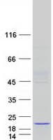 Human ATAD4 Protein (Recombinant Myc-DDK (Flag))