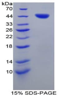 Pig Tryptase Protein (Recombinant His-GST)