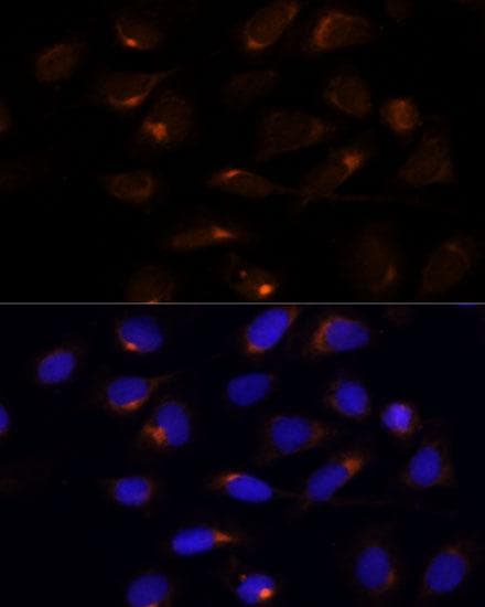 SCD1 / SCD Antibody