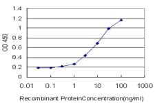 IHC-plus™ TLN1 / Talin 1 Antibody (clone 1A11)