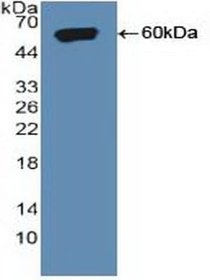 SORT1 / Sortilin Antibody (aa50-320, APC)