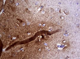 VILIP / VSNL1 Antibody (aa2-191, clone OTI2E5)