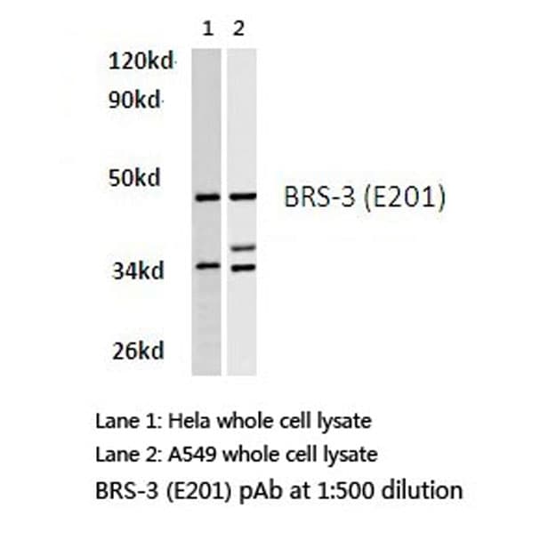 BRS3 Antibody (Glu201)