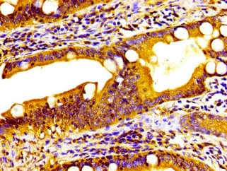 HSD2 / HSD11B2 Antibody