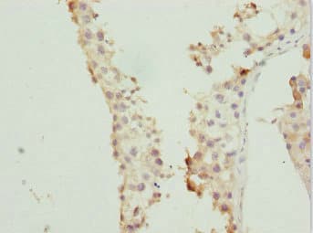 Polyclonal Rabbit anti-Human RAB5C Antibody (IHC)
