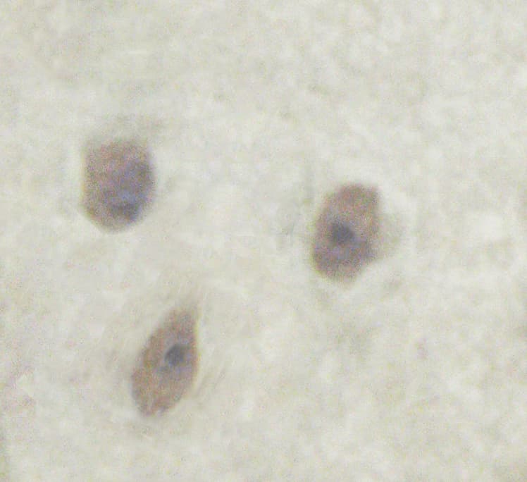 SNCA / Alpha-Synuclein Antibody (phospho-Ser129)