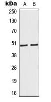 CASP9 / Caspase 9 Antibody (Internal)