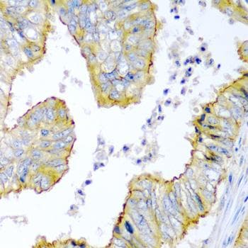 ZNF673 Antibody