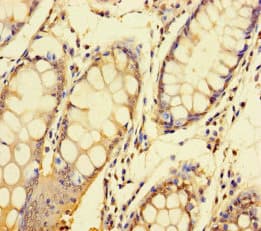NDUFAF1 / CIA30 Antibody