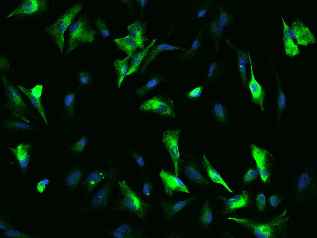Polyclonal Rabbit anti-Human OTUD7B / Cezanne Antibody (IF)