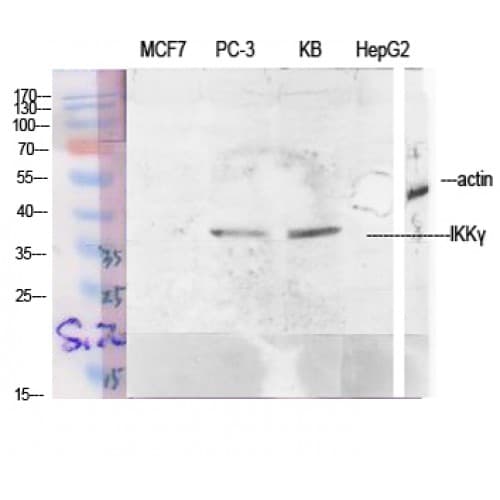 Polyclonal Rabbit anti-Human IKBKG / NEMO / IKK Gamma Antibody (30-110 aa, IHC, IF, WB)