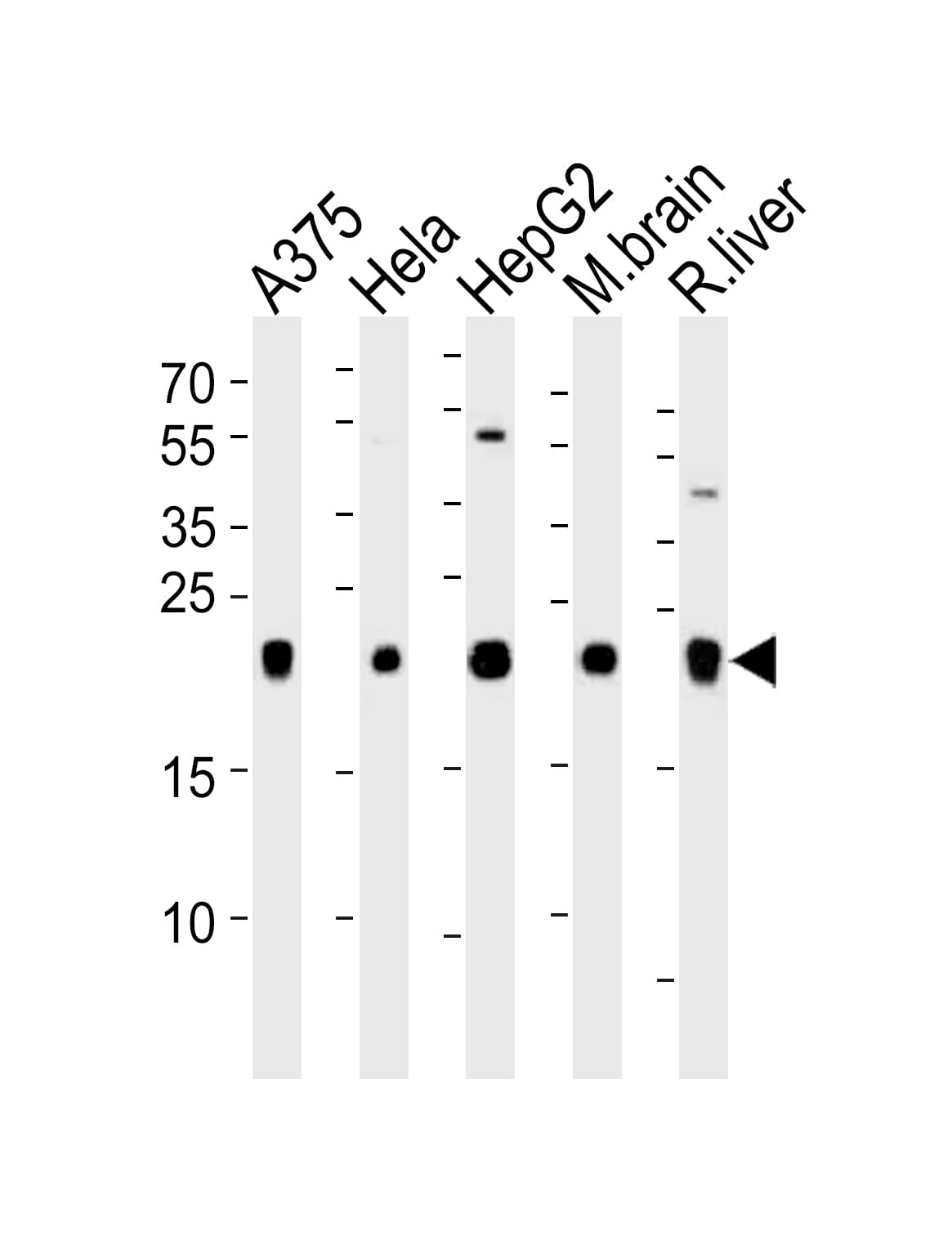 ITPA Antibody (aa24-51)