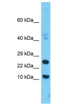 Polyclonal Rabbit anti-Human FAM159B Antibody (FITC, aa96-145, WB)
