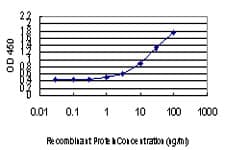 IHC-plus™ DLX2 Antibody (clone 2E12)