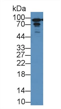 PYGL Antibody (aa603-750)