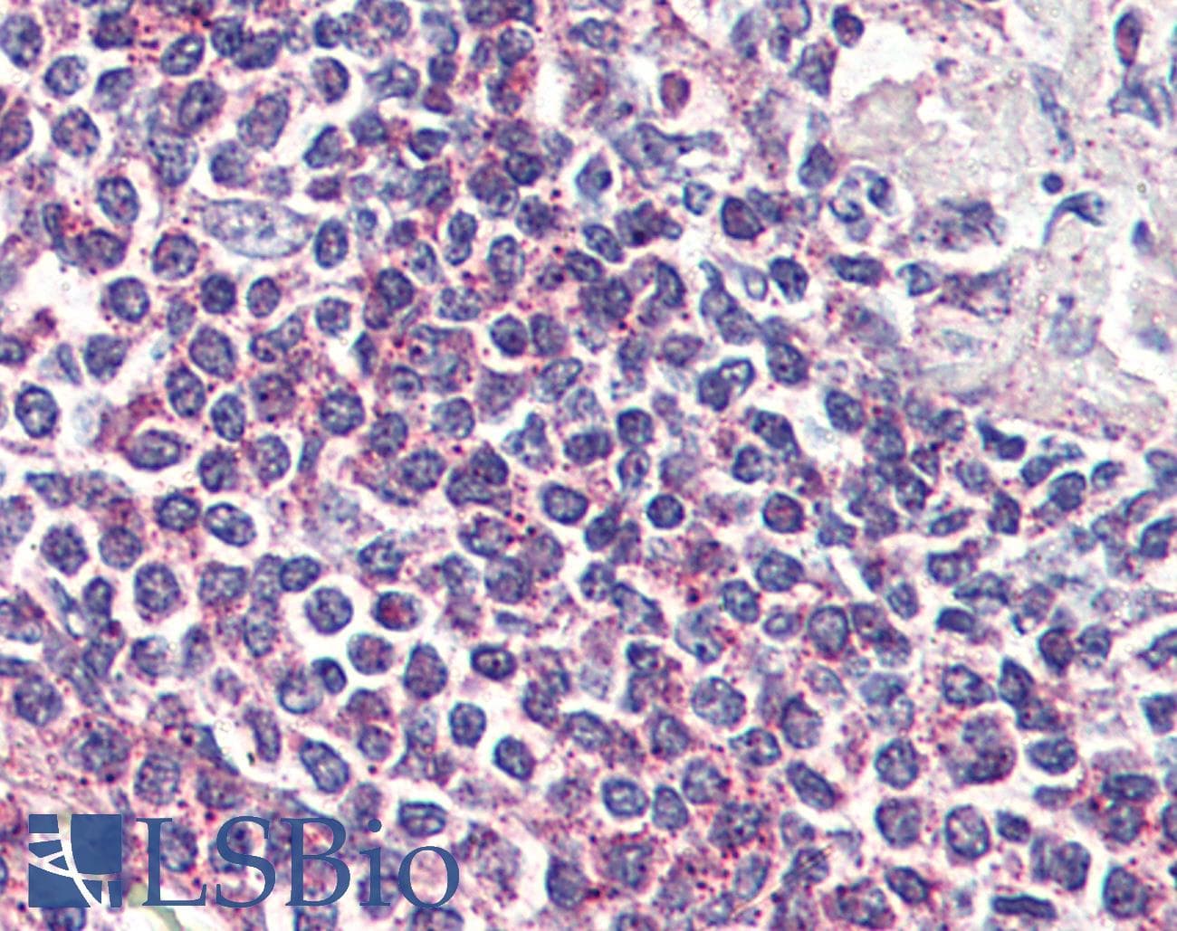 IHC-plus™ GPR132 / G2A Antibody (Internal)