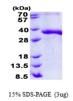 Human JAM2 Protein (Recombinant His)