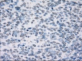 SORD / Sorbitol Dehydrogenase Antibody (clone OTI12A7)